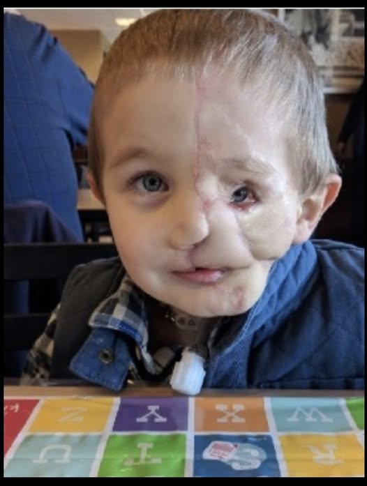 Boy, 5, survives savage attack by two dogs only to be called a ‘monster’ in public