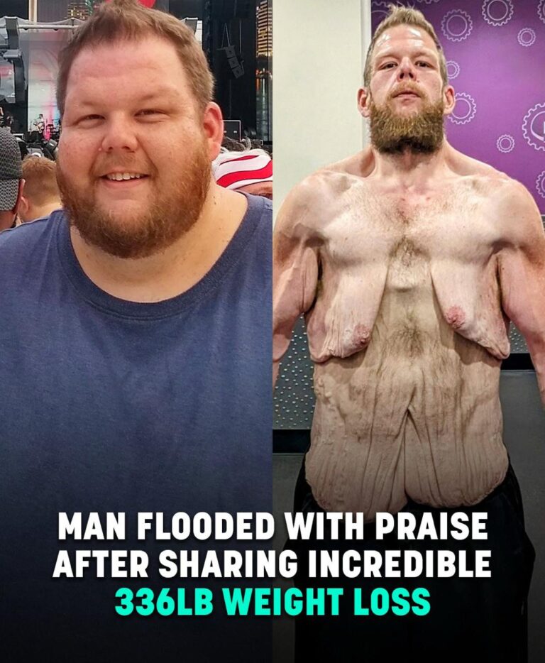 Social media users are applauding a man after he successfully lost 360 pounds.