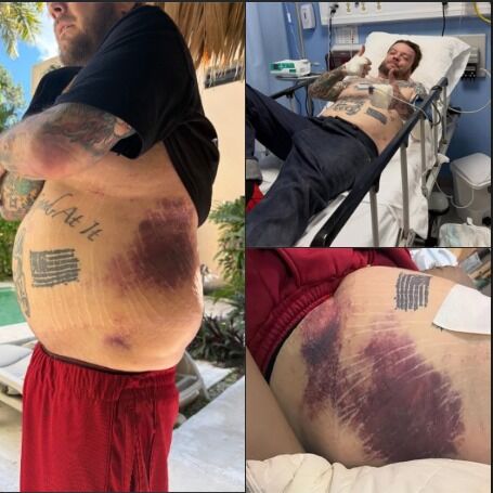 Pawn Stars’ Corey Harrison Speaks Out After Serious Accident: Recovery, Financial Struggles, and a Message to Fans