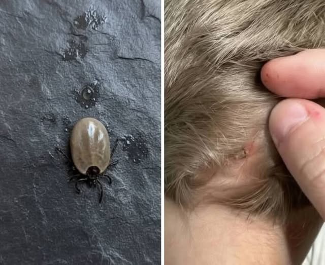 The Little Scalp Invader: What Parents Should Do When a Strange Bug Appears in Their Child’s Hair