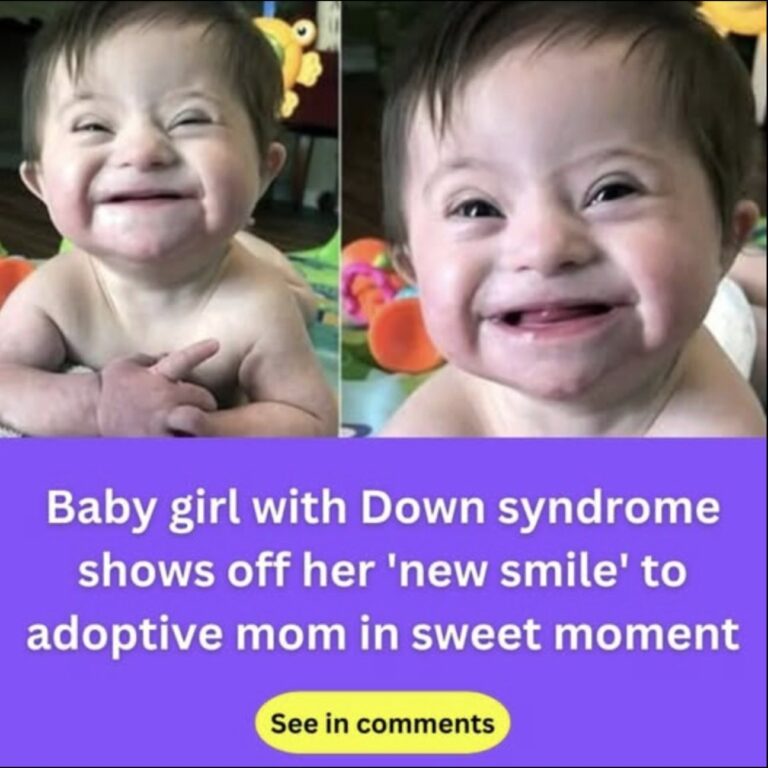 Adopted baby with Down syndrome goes viral after smiling for mom