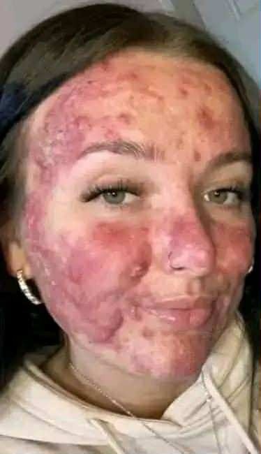 Her body was itching, I thought it was an allergy, they diagnosed ca… see more