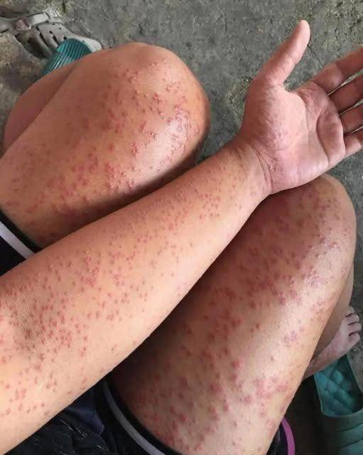 These are the consequences of sleeping with…See more in comment