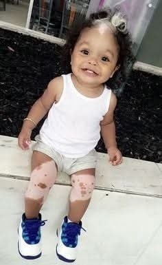 Community Mourns After Toddler’s Life Cut Short in Tragic Family Incident