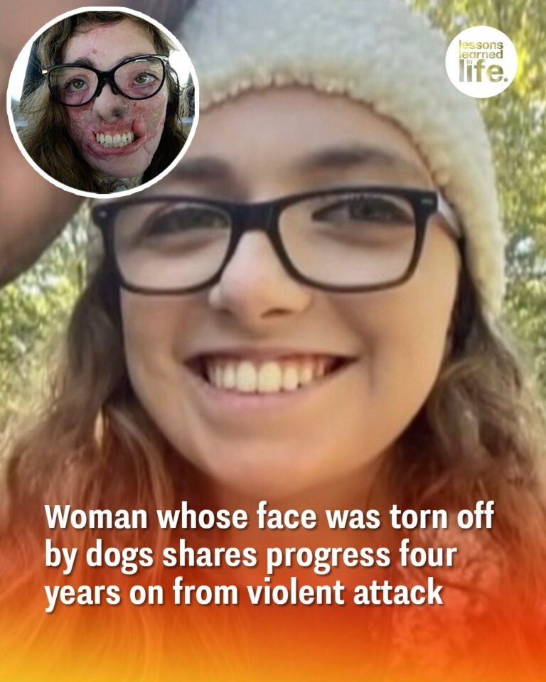 She Survived What Should Have Killed Her