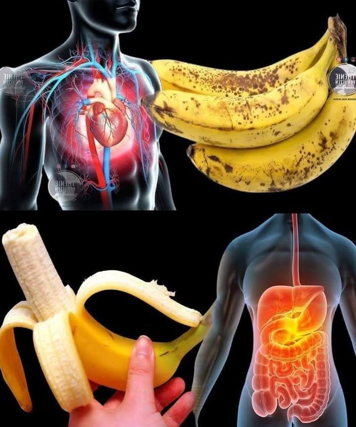 Doctor reveals what eating bananas can really do – surprising effects you need to know!