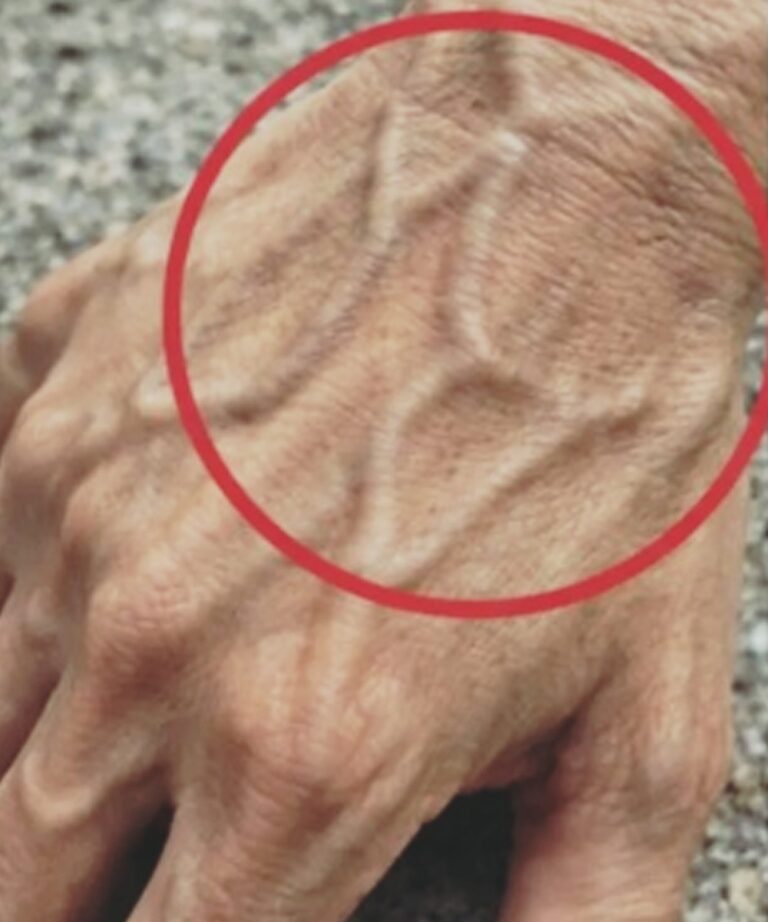 What Visible Veins Might Say About Your Body