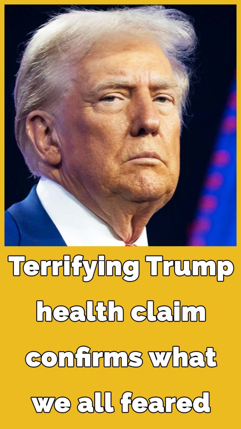 Fans Notice Something Unusual in Trump’s Appearance and Speculate About His Health