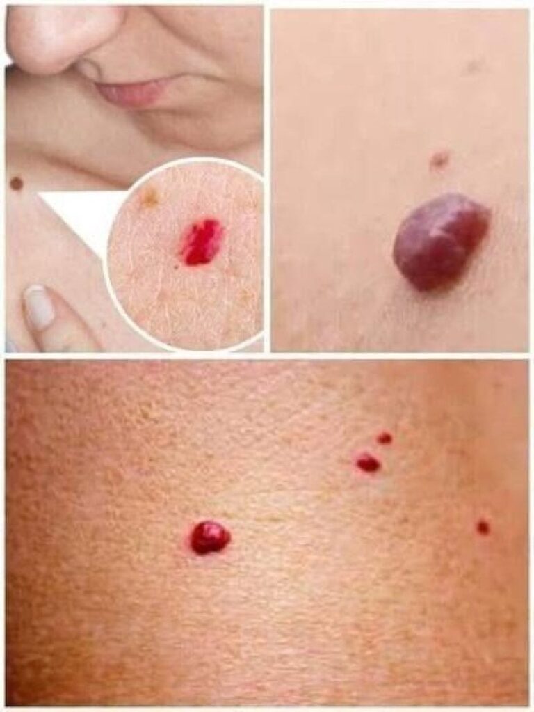What Small Red Dots on Your Skin Might Be Telling You