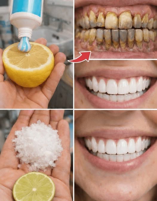 A clean, bright smile is something many people appreciate—not just for aesthetic reasons, but also for the sense of confidence it can bring. Whether you’re meeting someone new, taking photos, or simply going about your daily routine, feeling good about your smile can positively influence how you present yourself to the world.
