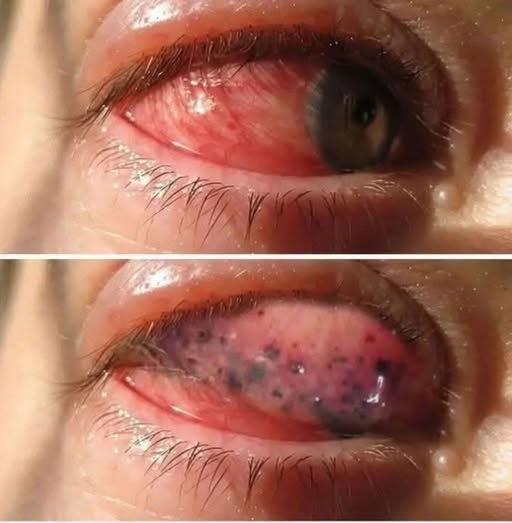 These Are the Signs That His Body Is Crying for Help — Don’t Ignore Them
