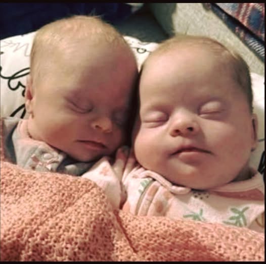Mother of twins with Down syndrome responds powerfully to online criticism
