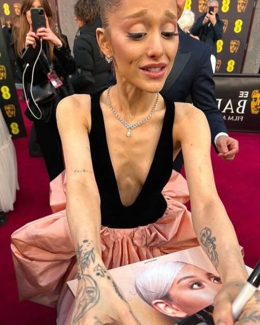 How Ariana Grande Managed Her Recovery While Protecting Her Voice