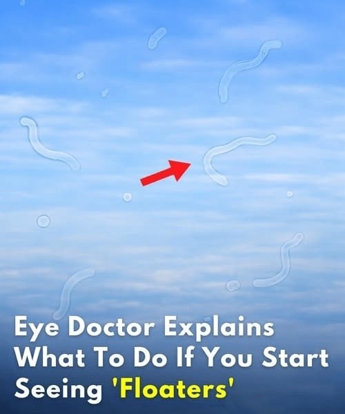 What to Do If You Start Seeing Eye Floaters…See more’