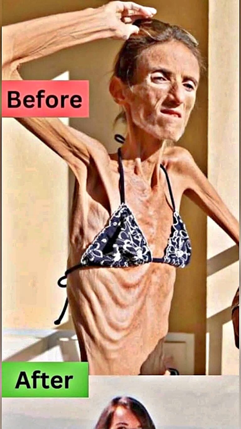 She Was Given Weeks to Live — Then Everything Changed